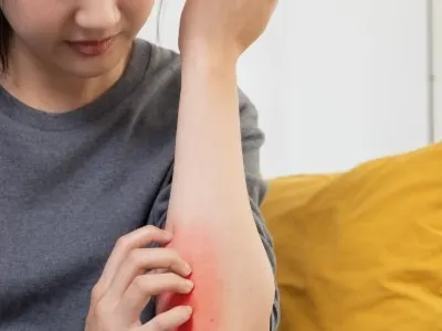 A woman on a sofa scratching a red, irritated patch on the inside of her forearm