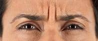 woman's brow with frow line